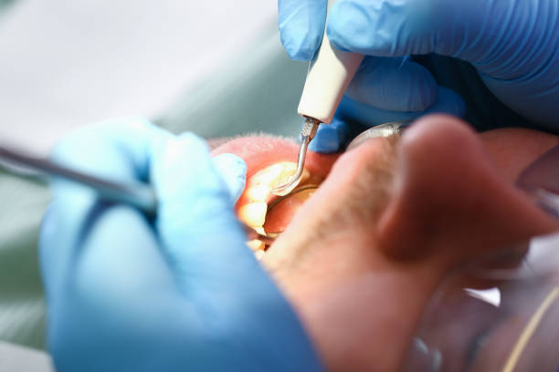 Best Emergency Treatment for Dental Infections or Abscesses in Holloman Af, NM
